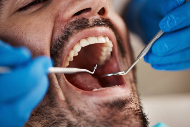 Best Pediatric Emergency Dentist in Quanah, TX